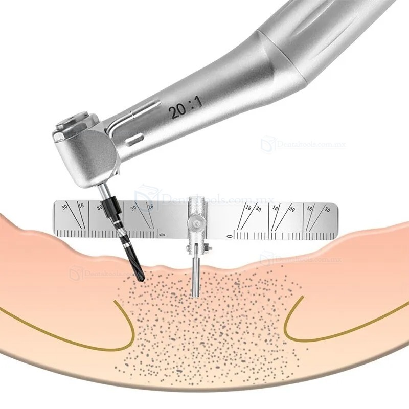 Gu&iacute;a angular flexible para posicionamiento de implantes dentales